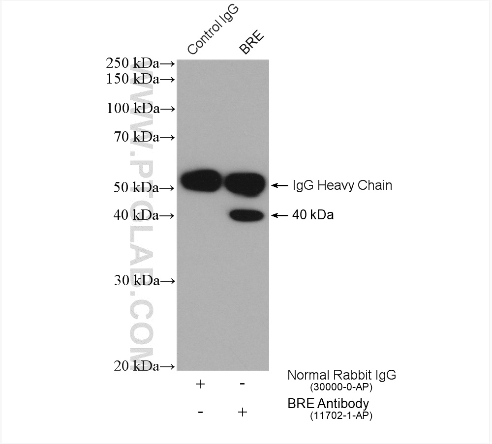 IP experiment of HeLa using 11702-1-AP