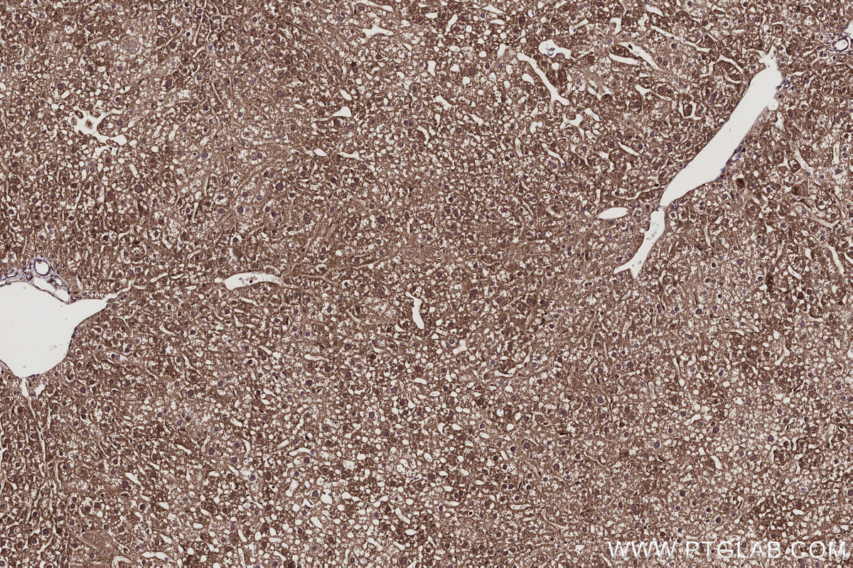 IHC staining of mouse liver using 66356-1-Ig IHC staining of mouse liver using 66356-1-Ig