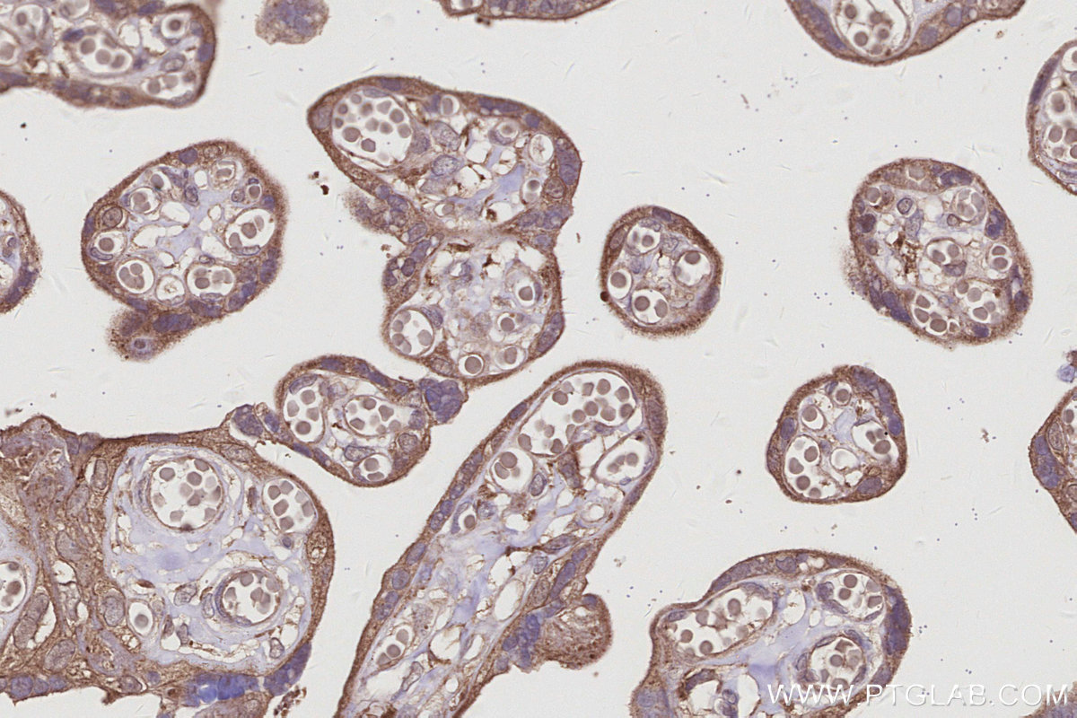 IHC staining of human placenta using 66356-1-Ig IHC staining of human placenta using 66356-1-Ig