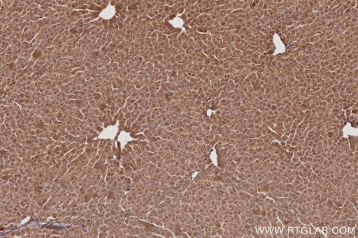 IHC staining of rat liver using 66356-1-Ig IHC staining of rat liver using 66356-1-Ig