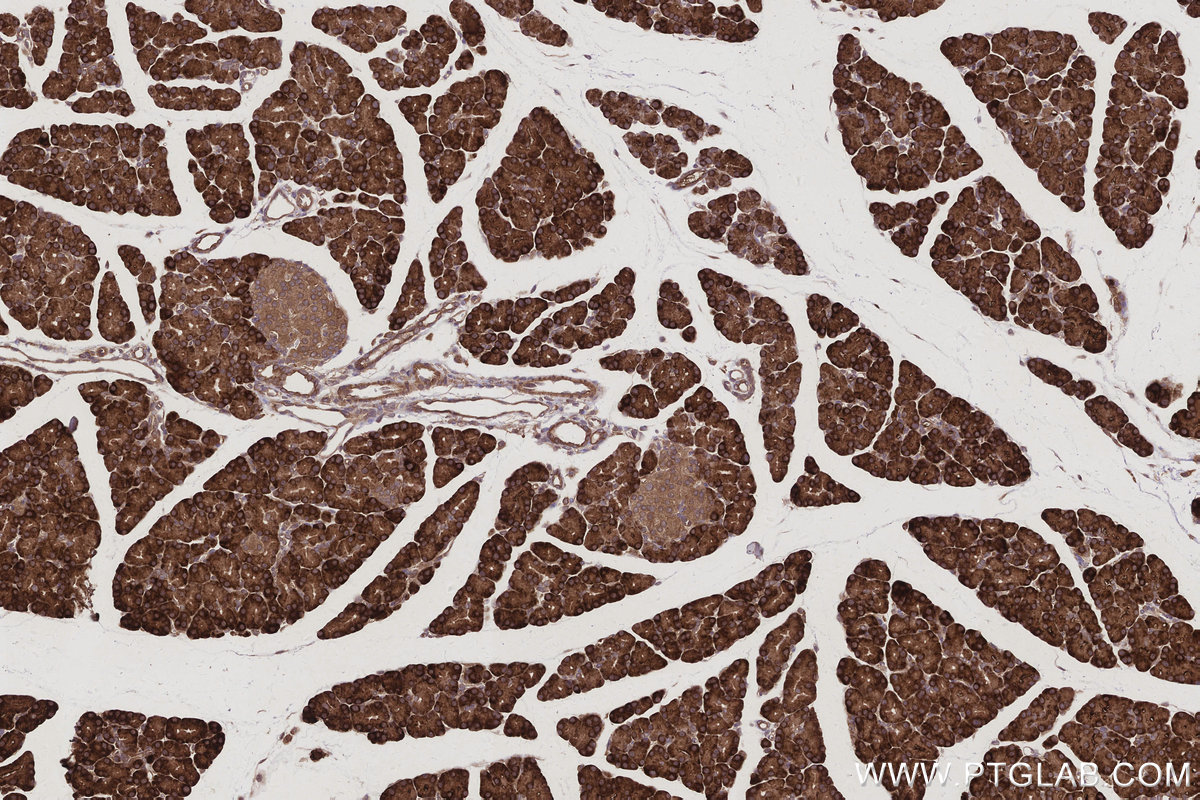 IHC staining of rat pancreas using 66356-1-Ig IHC staining of rat pancreas using 66356-1-Ig