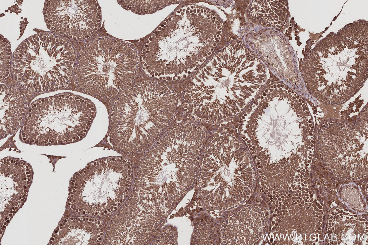 IHC staining of rat testis using 66356-1-Ig IHC staining of rat testis using 66356-1-Ig