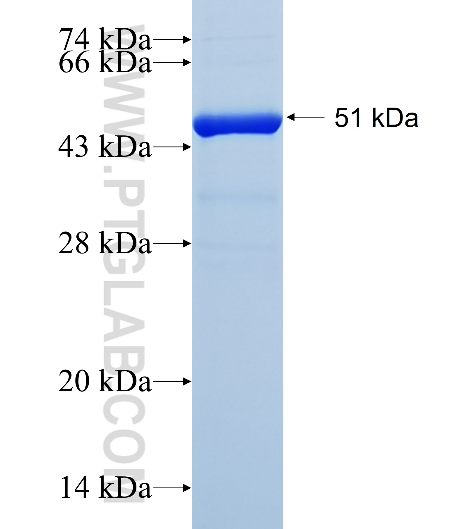 BRF1 fusion protein Ag41622 SDS-PAGE BRF1 fusion protein Ag41622 SDS-PAGE