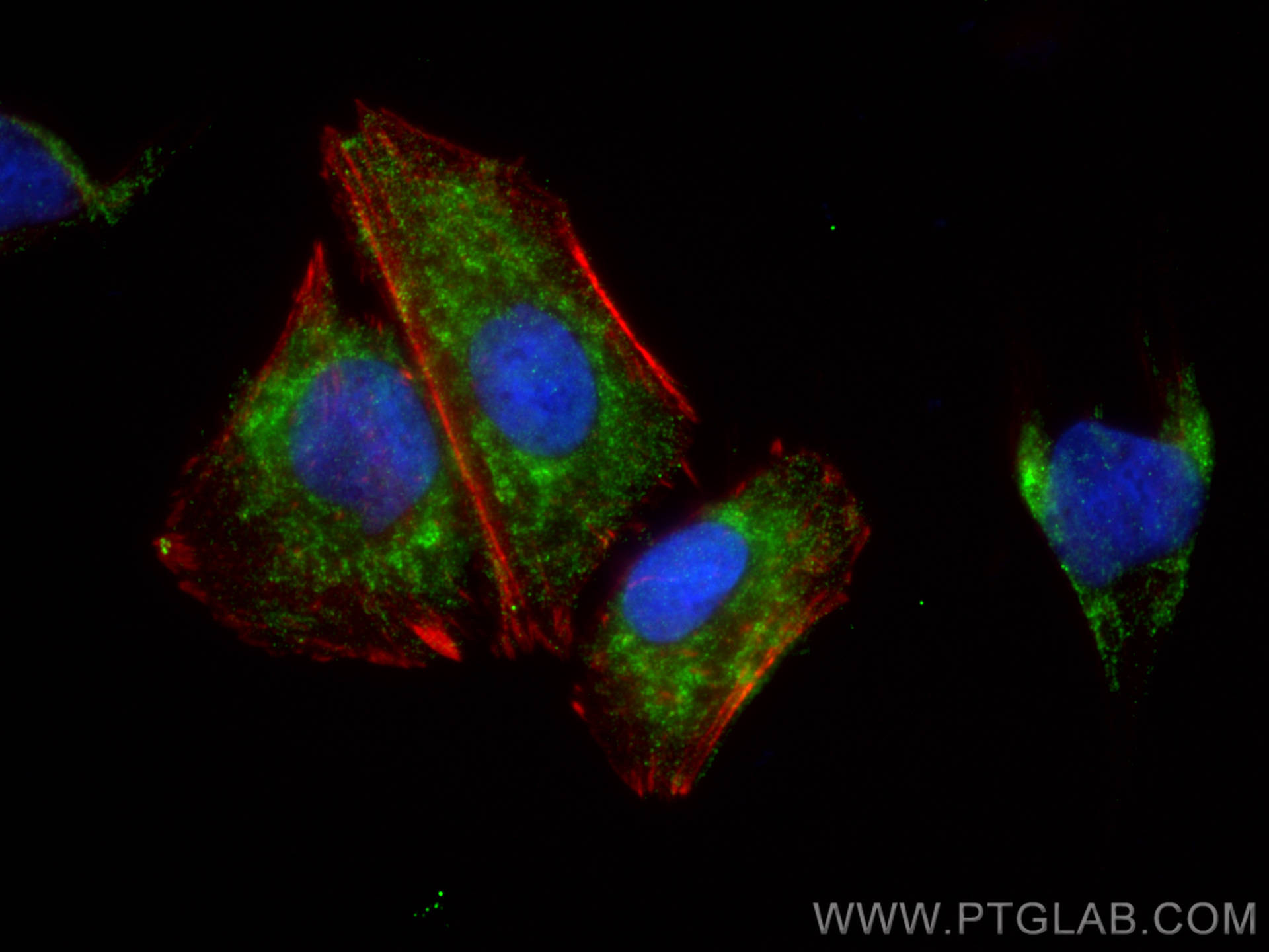 IF Staining of SH-SY5Y using 26884-1-AP