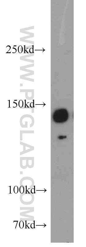 WB analysis of HeLa using 20983-1-AP