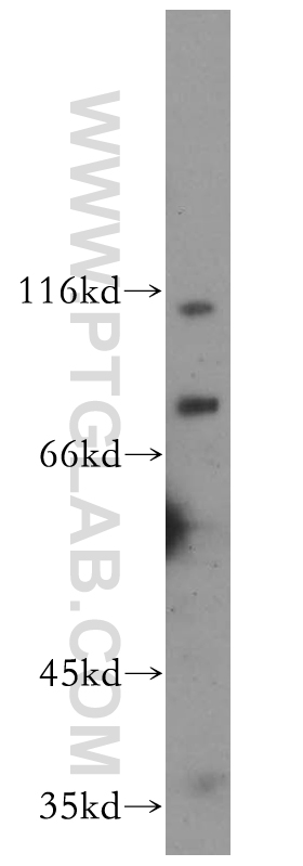 WB analysis of HeLa using 11962-1-AP