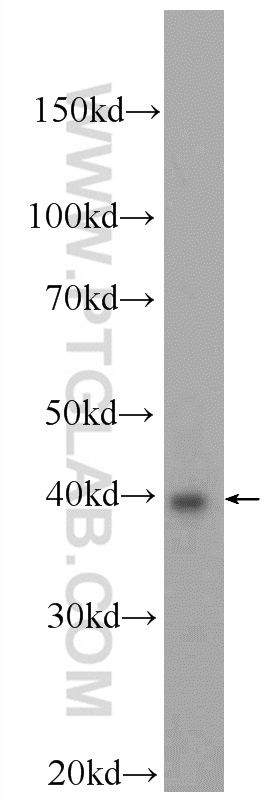 MCF-7 cells were subjected to SDS PAGE followed by western blot with 23989-1-AP (BRMS1L Antibody) at dilution of 1:600 incubated at room temperature for 1.5 hours. WB analysis of MCF-7 using 23989-1-AP