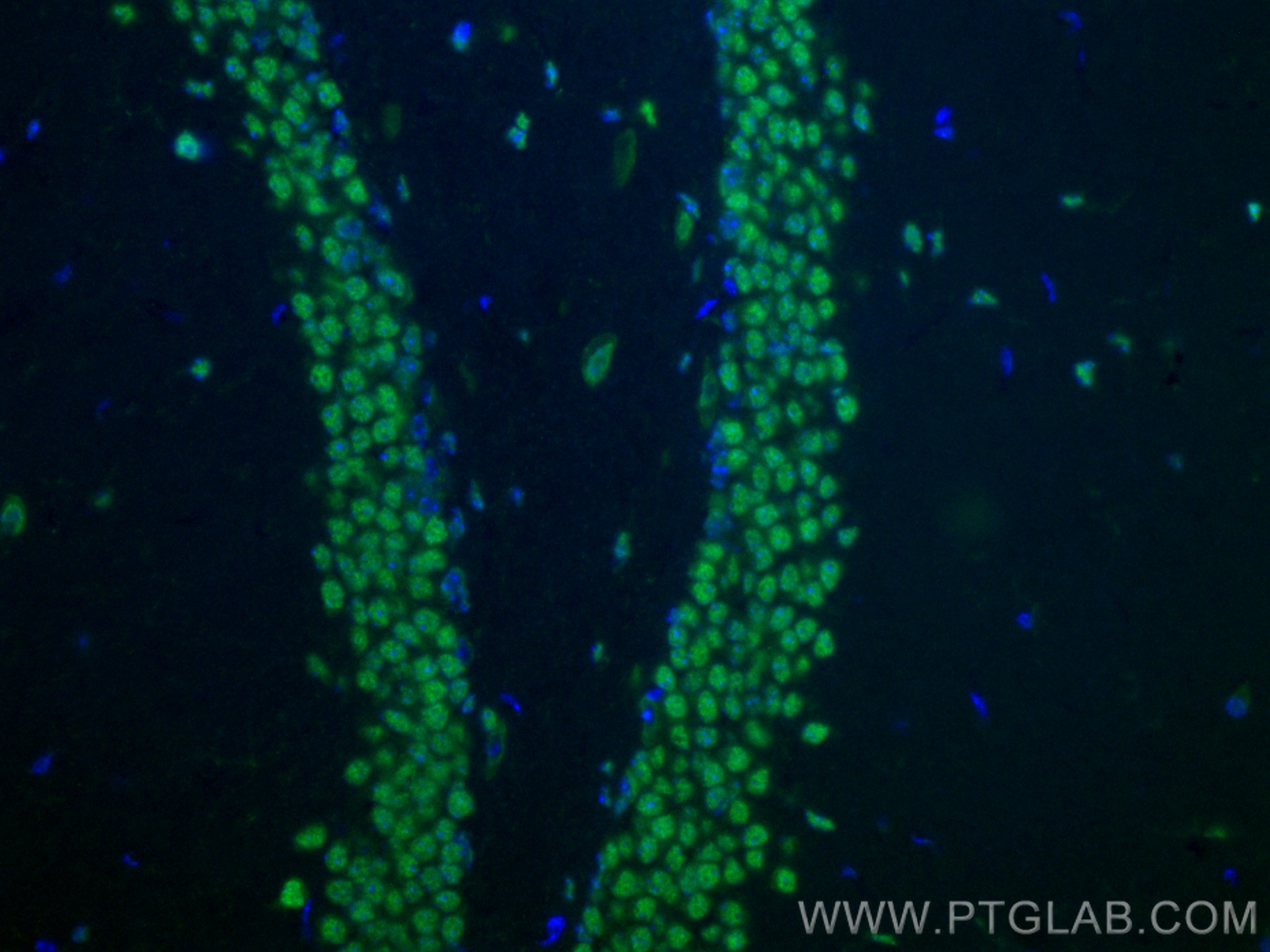 IF Staining of mouse brain using CL488-14596