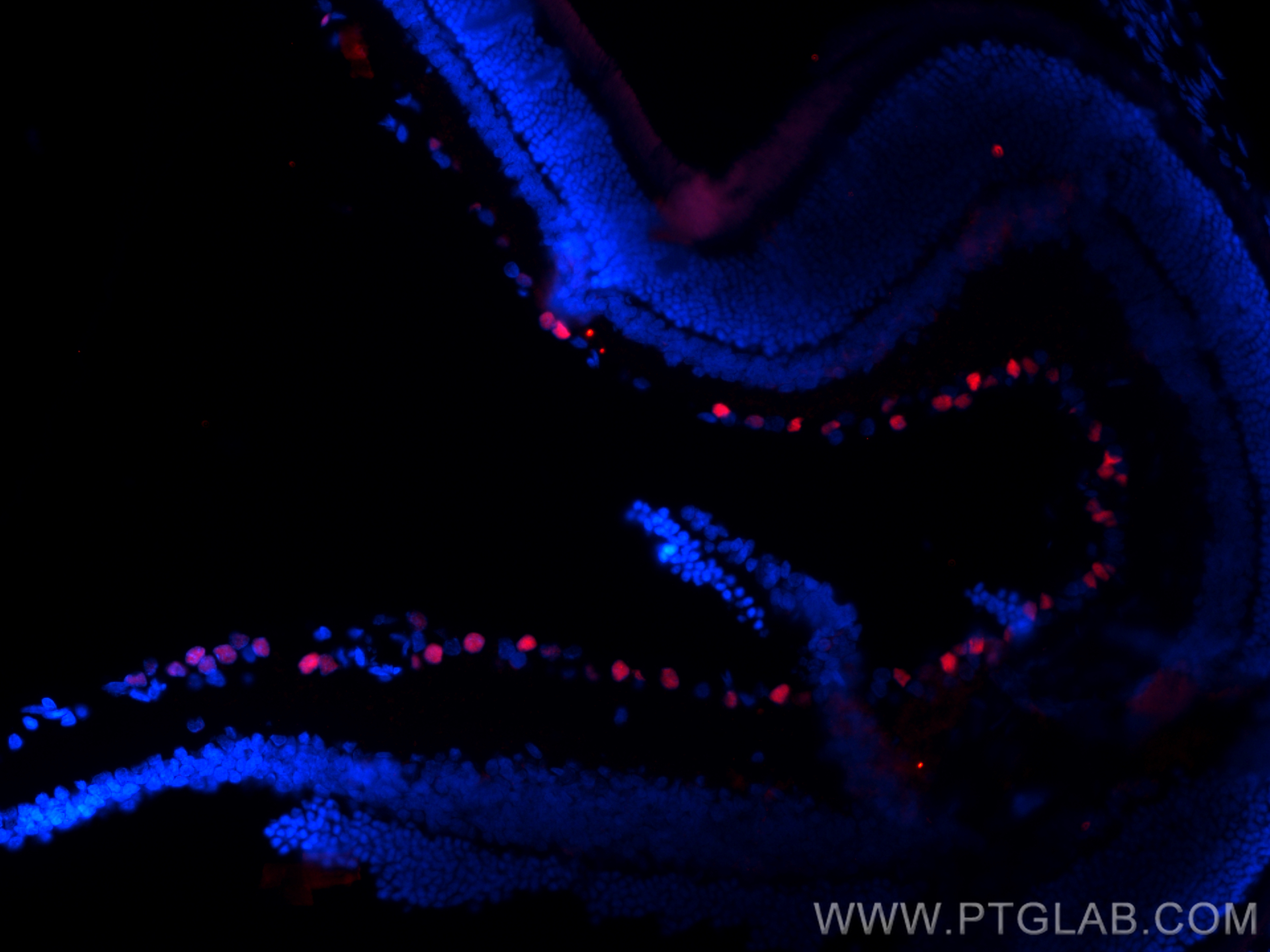 IF Staining of rat eye using 32257-1-AP