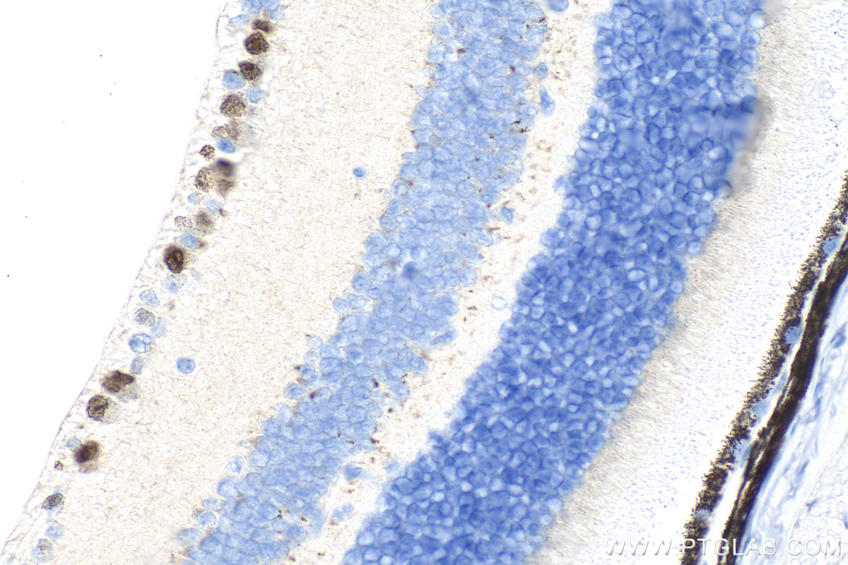 IHC staining of mouse eye using 32257-1-AP