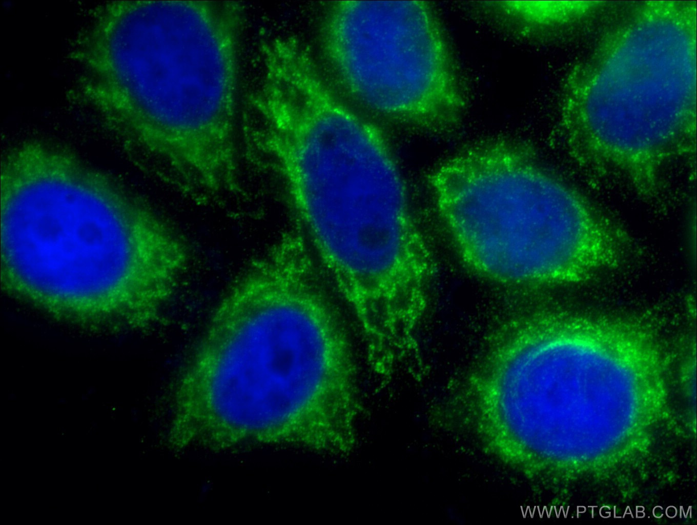 IF Staining of HepG2 using 20049-1-AP