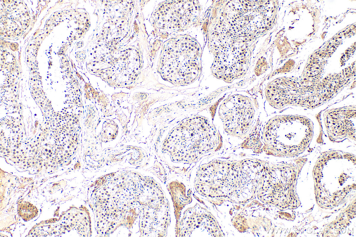 IHC staining of human testis using 30186-1-AP IHC staining of human testis using 30186-1-AP