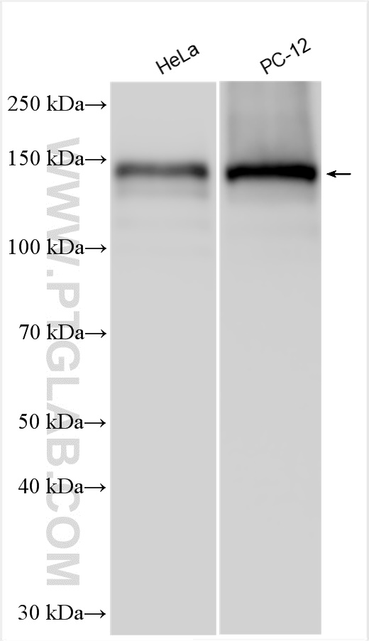 WB analysis using 30186-1-AP