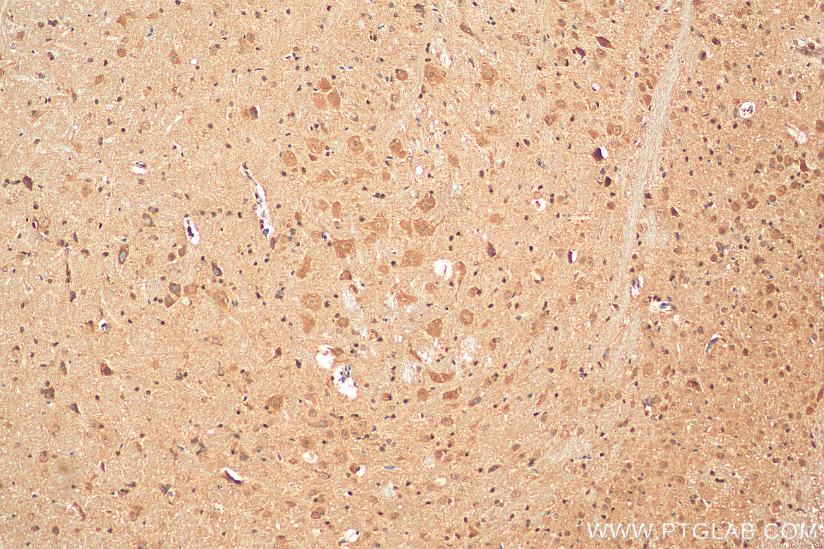IHC staining of mouse cerebellum using 29293-1-AP