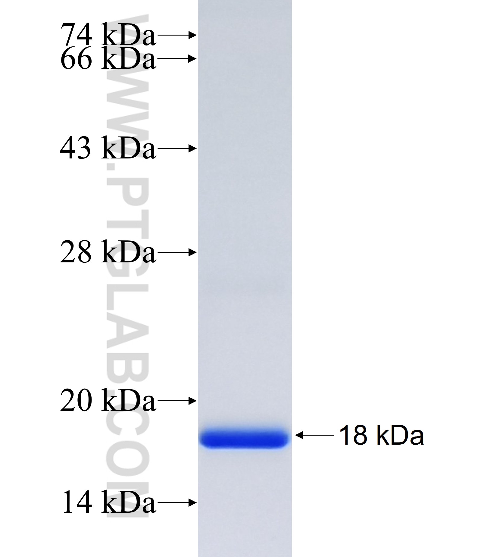 BRWD3 fusion protein Ag36961 SDS-PAGE BRWD3 fusion protein Ag36961 SDS-PAGE