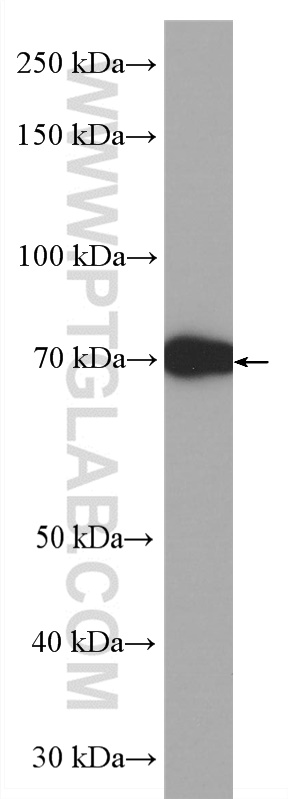 WB analysis of bovine serum using HRP-66201