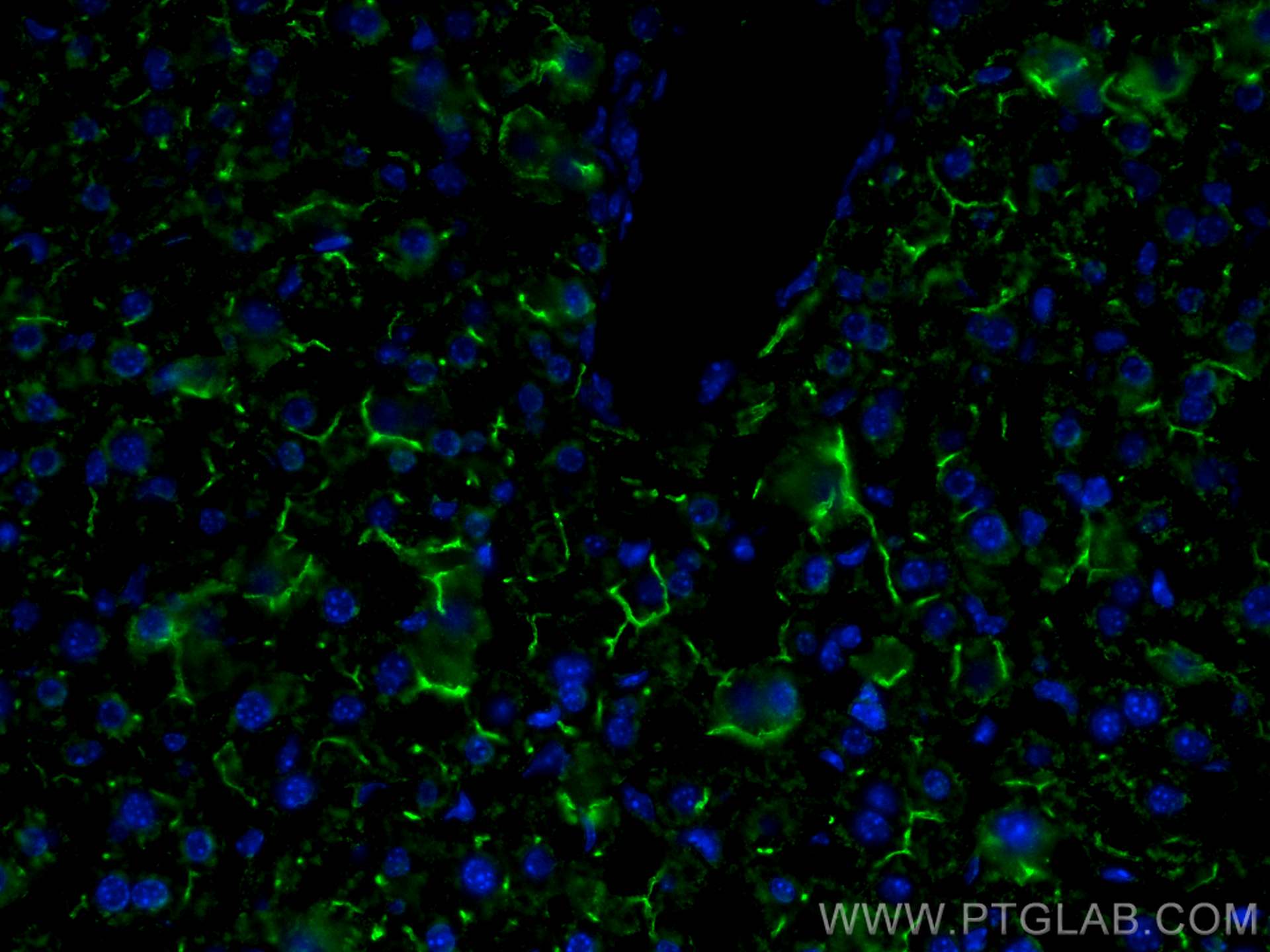 IF Staining of mouse liver using 67512-1-Ig (same clone as 67512-1-PBS)