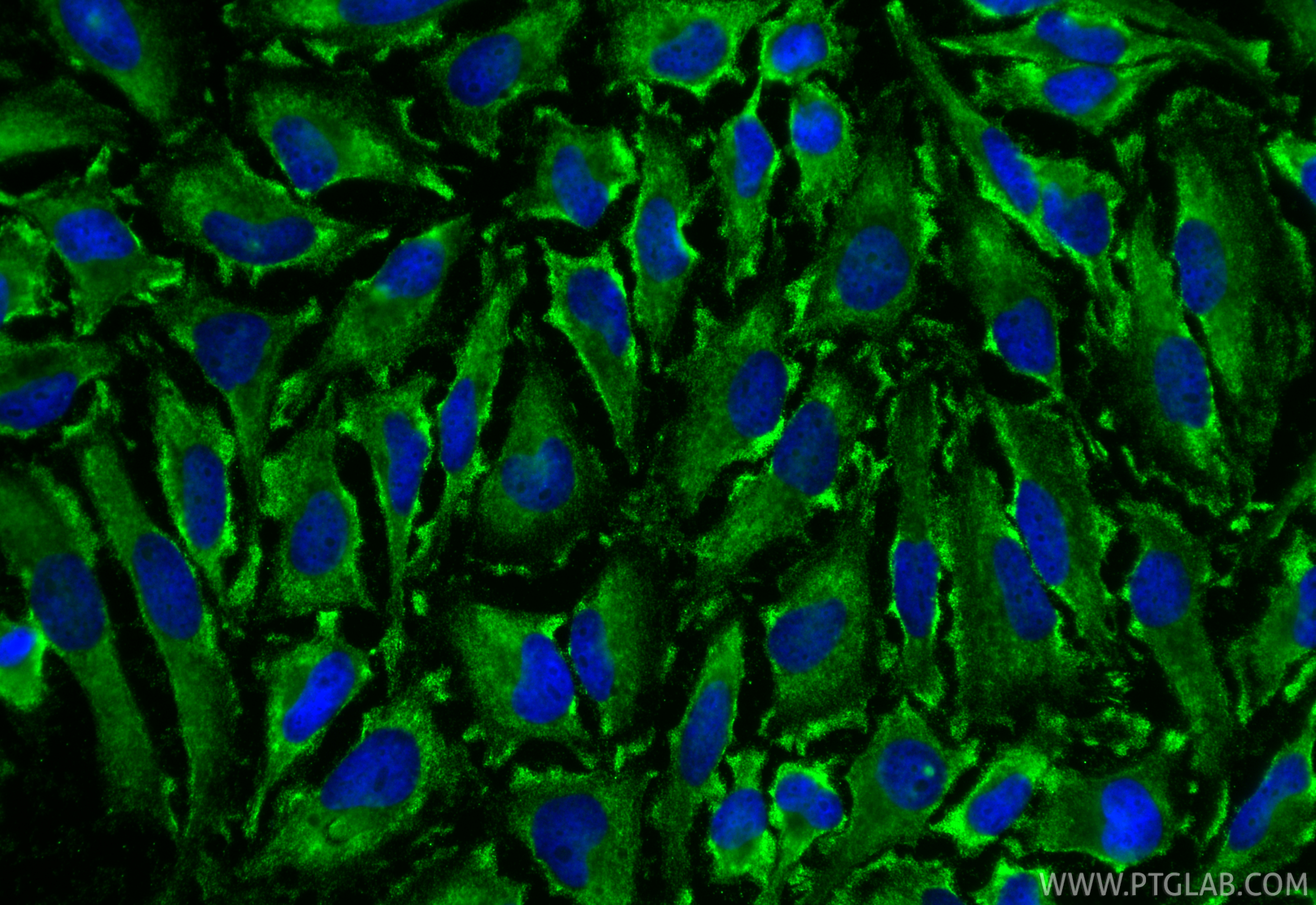 IF Staining of HeLa using 67512-1-Ig IF Staining of HeLa using 67512-1-Ig