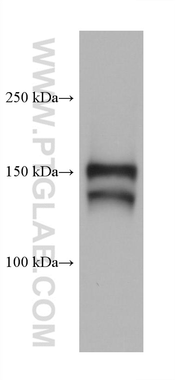 WB analysis of mouse liver using 67512-1-Ig (same clone as 67512-1-PBS)