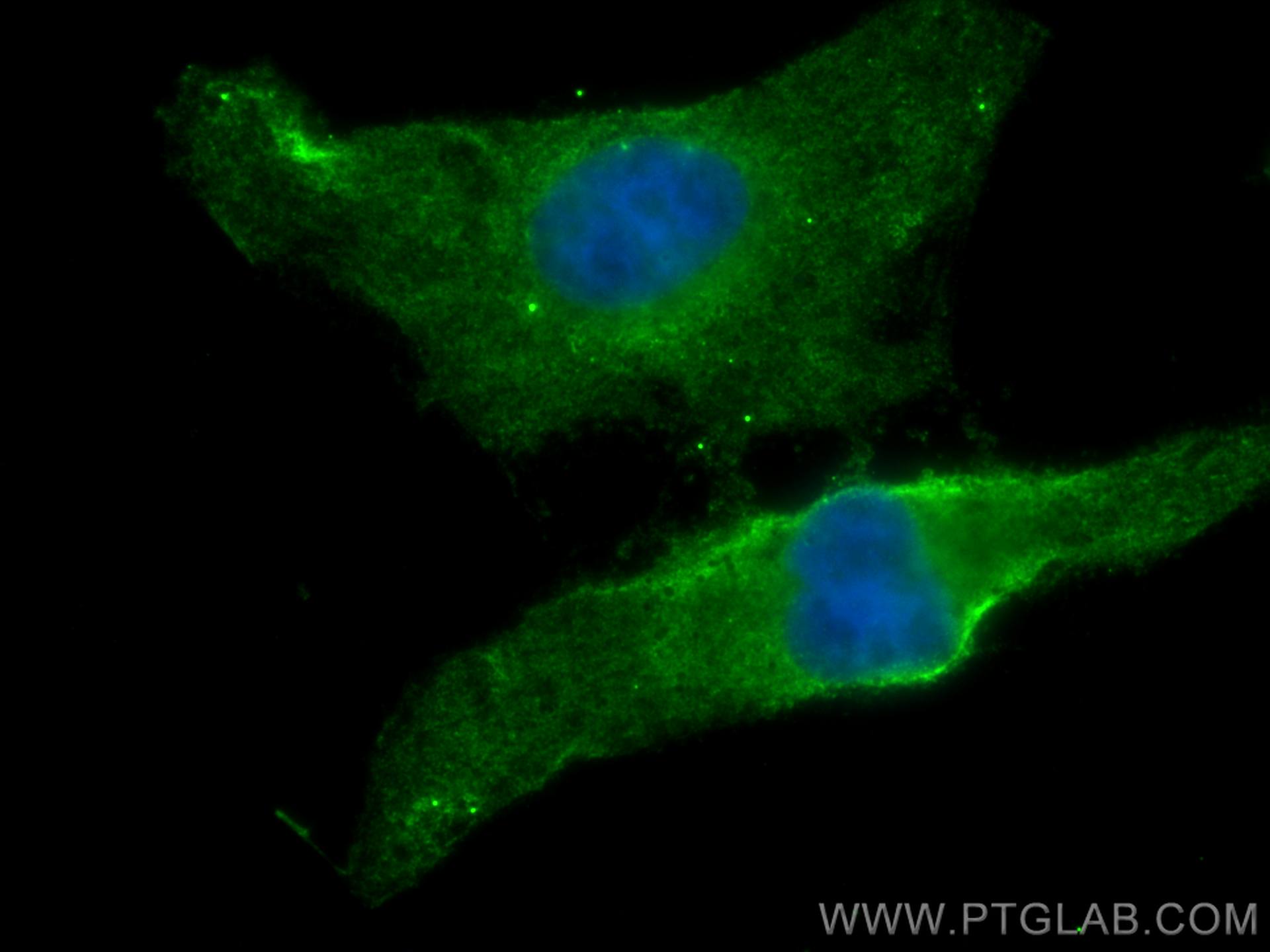 IF Staining of HeLa using CL488-67512