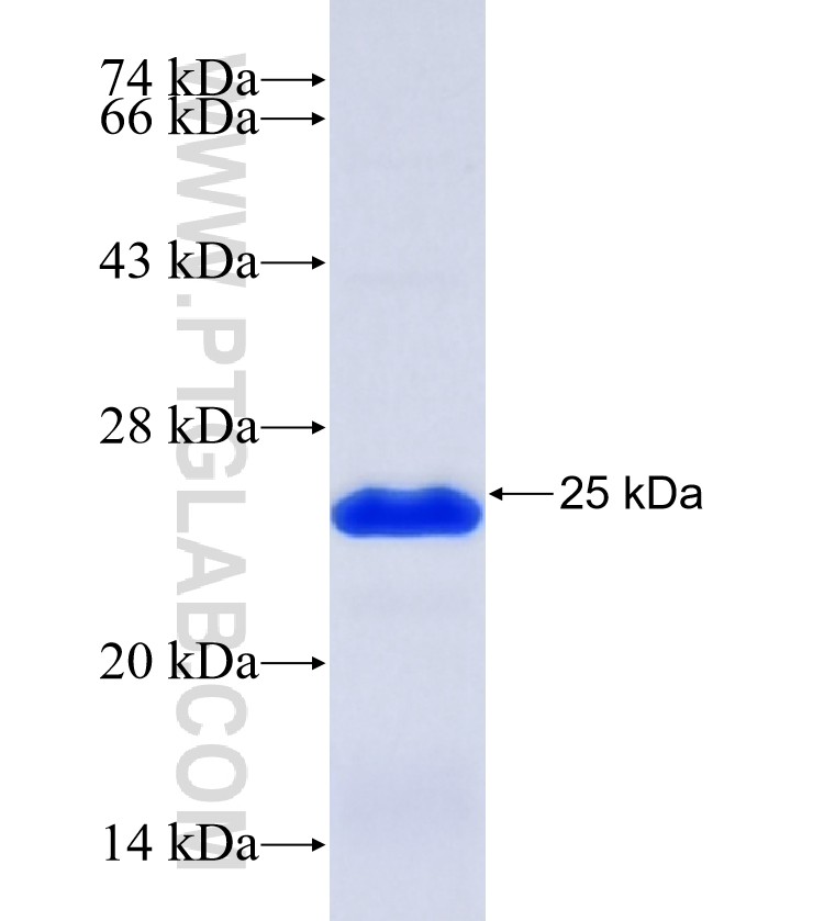 BSN fusion protein Ag26434 SDS-PAGE