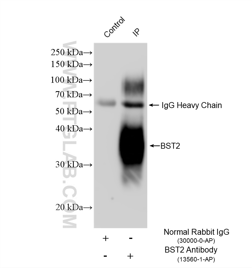 IP experiment of HeLa using 13560-1-AP