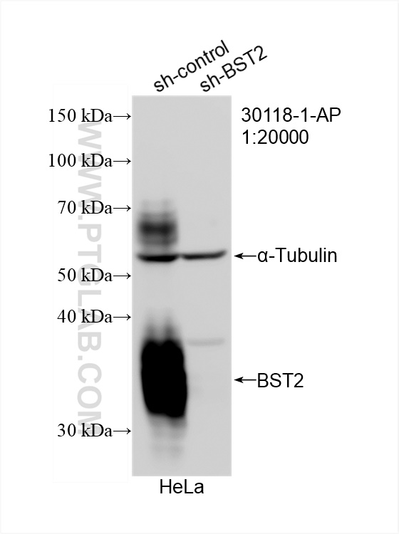 WB analysis of HeLa using 30118-1-AP