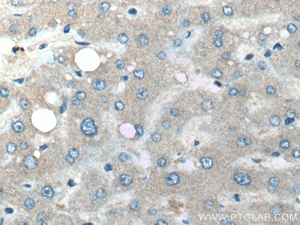 IHC staining of human liver using 66919-1-Ig (same clone as 66919-1-PBS)