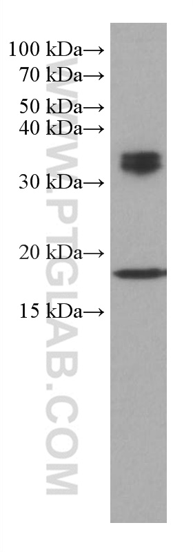 WB analysis of HeLa using 66919-1-Ig (same clone as 66919-1-PBS)
