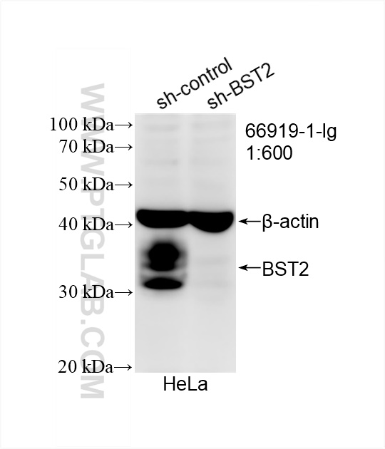 WB analysis of HeLa using 66919-1-Ig (same clone as 66919-1-PBS)