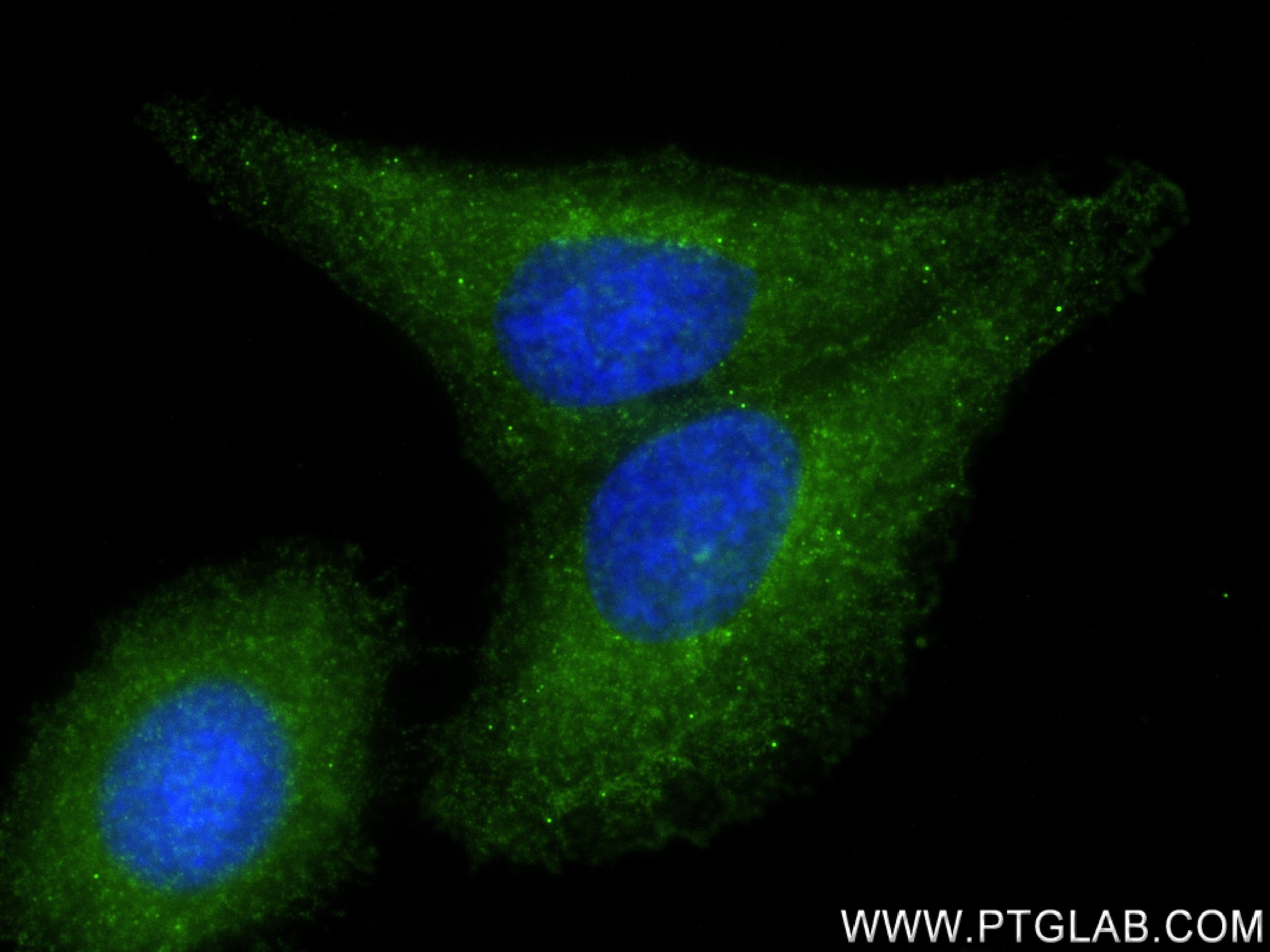 IF Staining of HepG2 using 82733-7-RR (same clone as 82733-7-PBS)