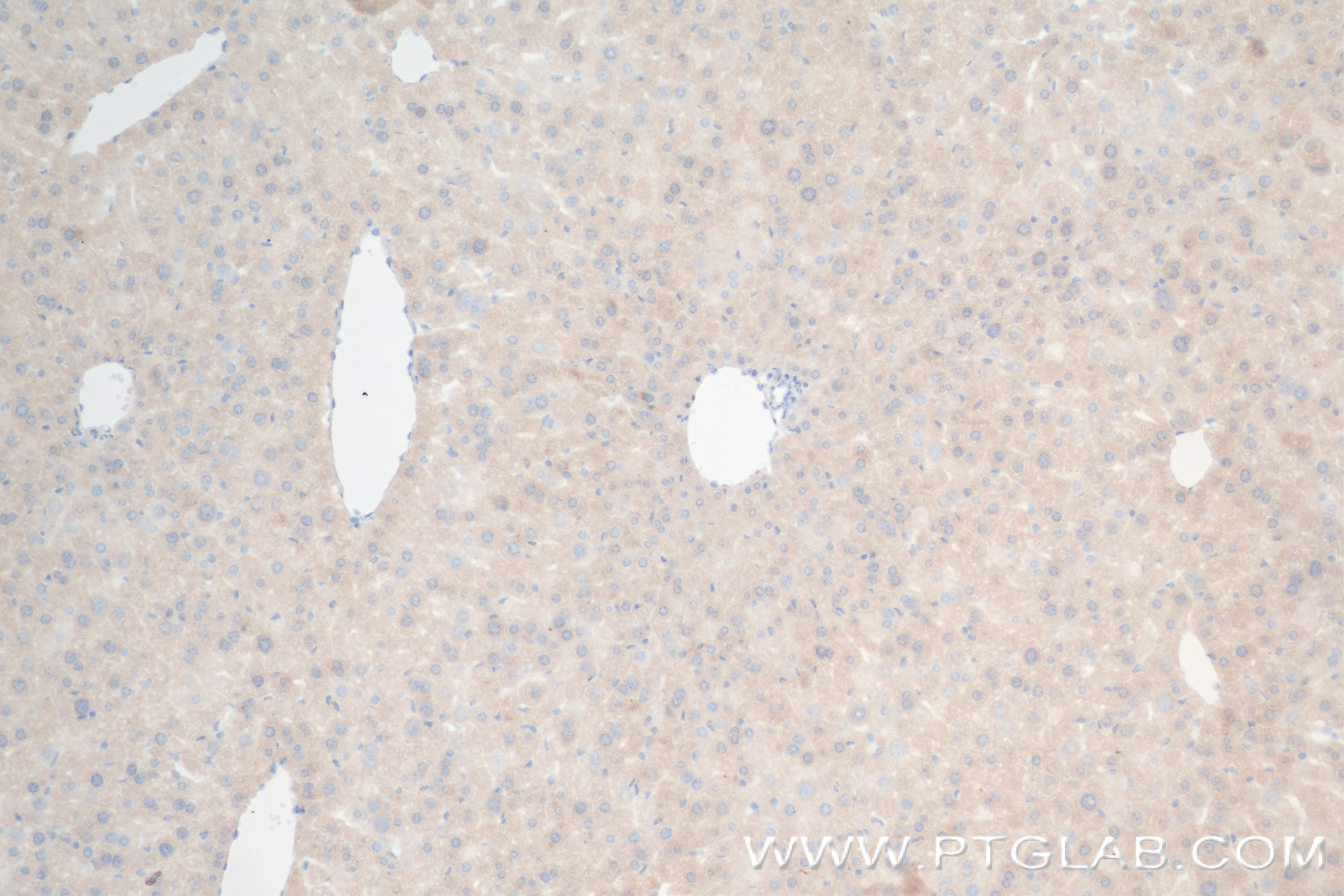 IHC staining of mouse liver using 84190-7-RR (same clone as 84190-7-PBS)
