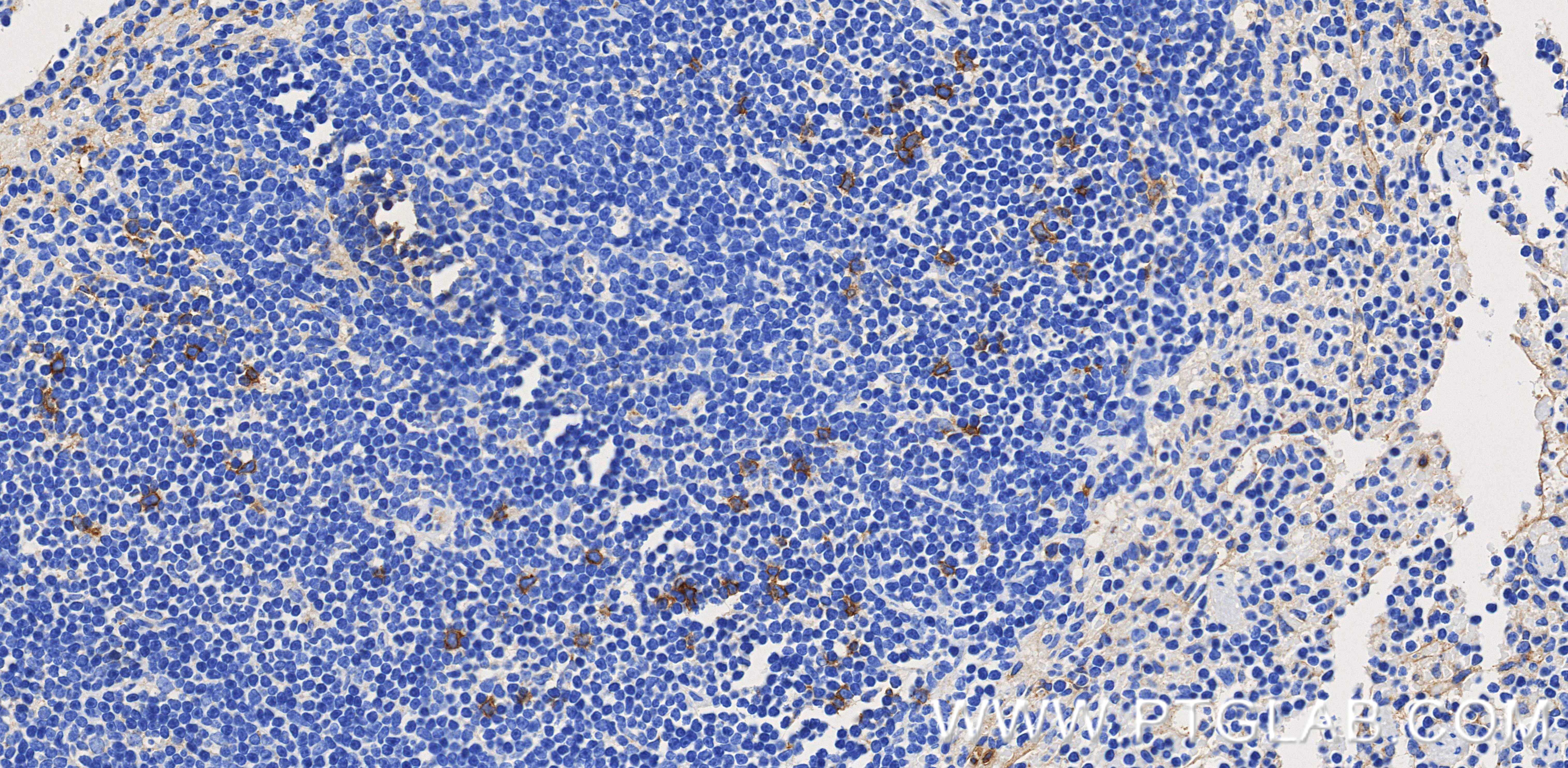 IHC staining of mouse spleen using 85614-4-RR