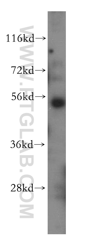 WB analysis of HeLa using 15859-1-AP