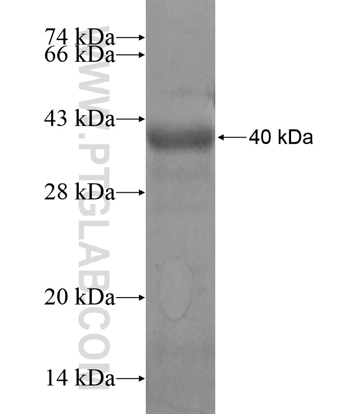 BTBD9 fusion protein Ag17256 SDS-PAGE BTBD9 fusion protein Ag17256 SDS-PAGE