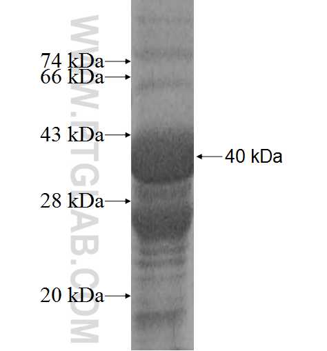 BTD fusion protein Ag9470 SDS-PAGE