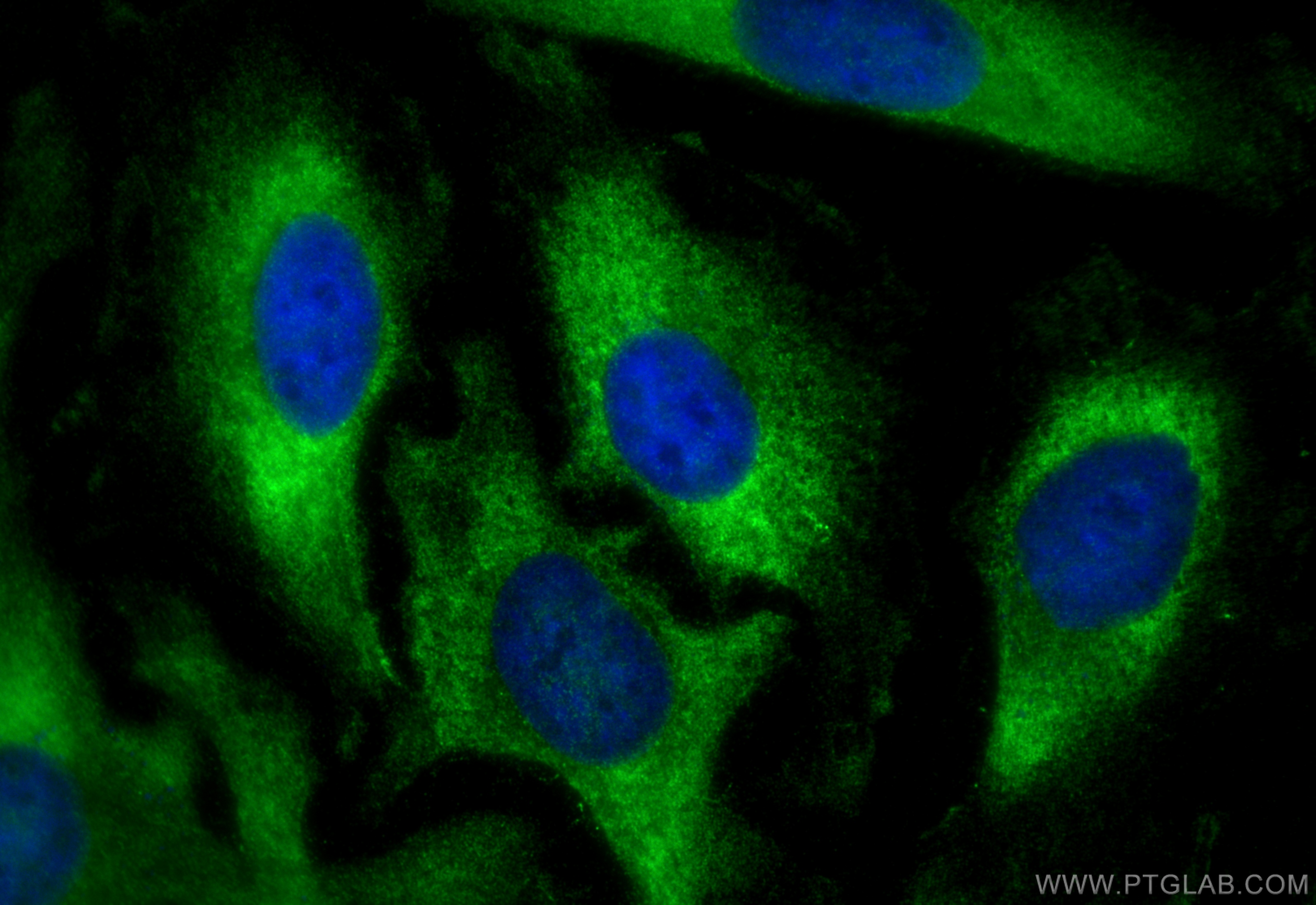 IF Staining of HeLa using 15415-1-AP