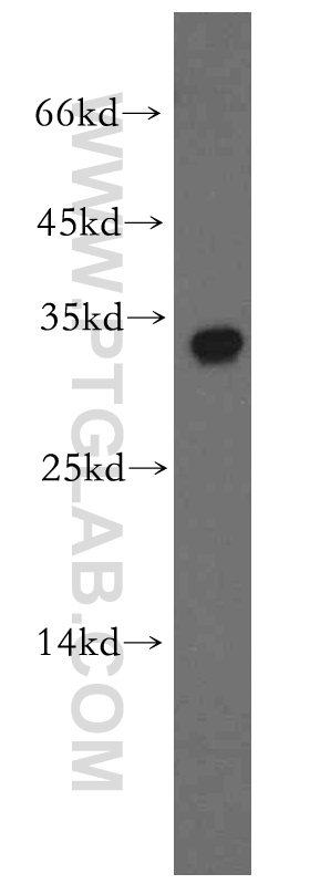 human brain tissue were subjected to SDS PAGE followed by western blot with 19753-1-AP (BTF3L3-Specific antibody) at dilution of 1:300 incubated at room temperature for 1.5 hours. WB analysis of human brain using 19753-1-AP