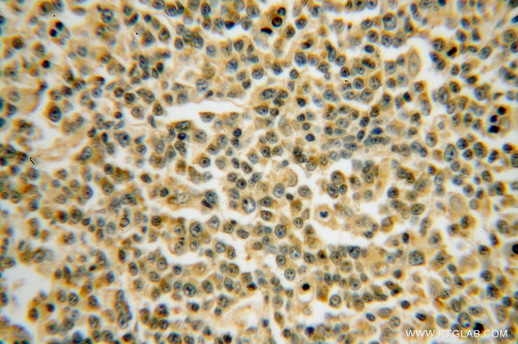 BTG1 Polyclonal antibody