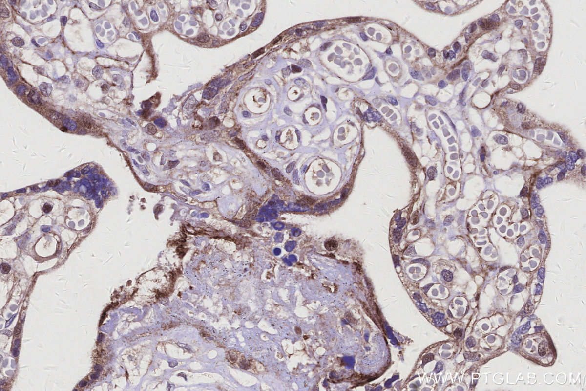 IHC staining of human placenta using 20336-1-AP IHC staining of human placenta using 20336-1-AP