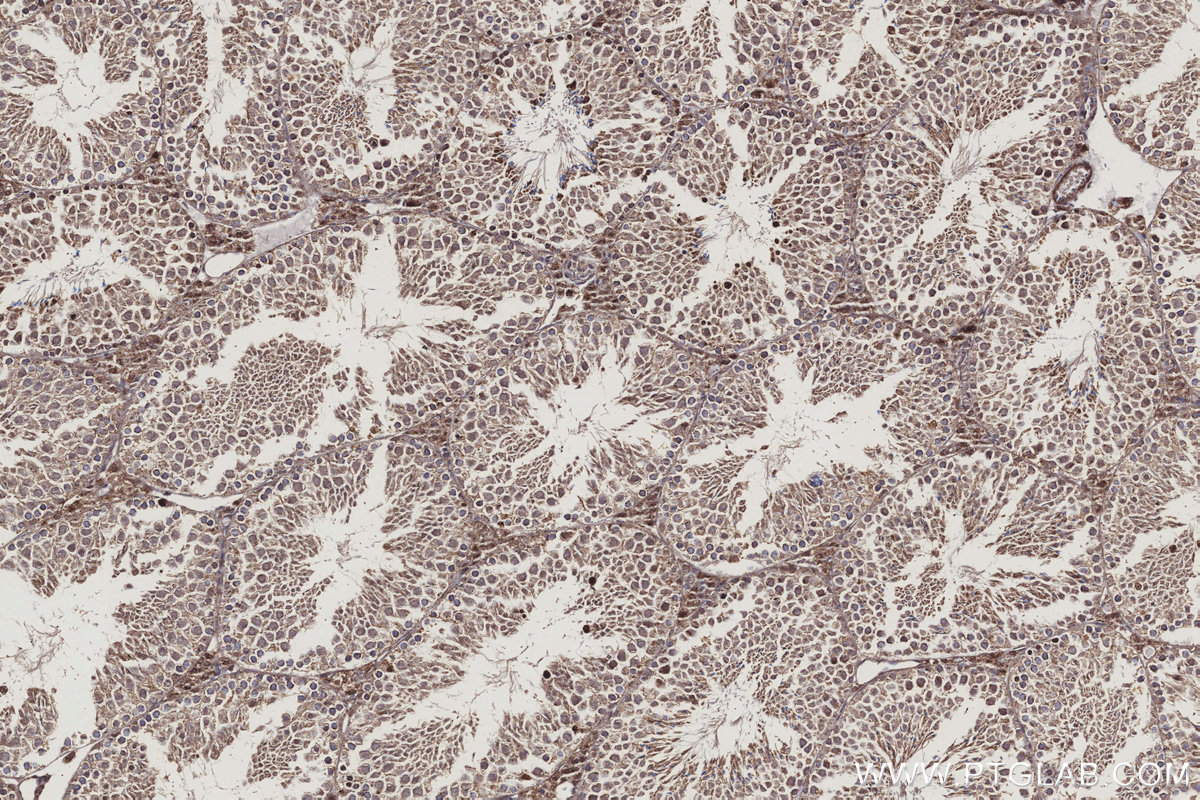 IHC staining of mouse testis using 20514-1-AP IHC staining of mouse testis using 20514-1-AP
