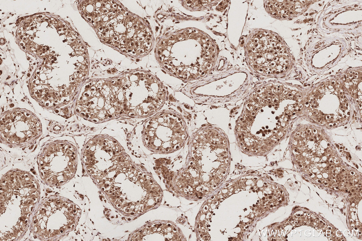 IHC staining of human testis using 20514-1-AP IHC staining of human testis using 20514-1-AP