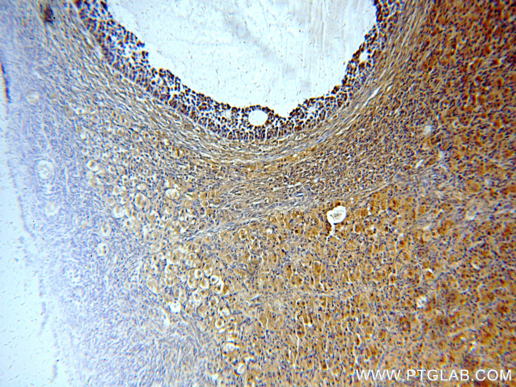 IHC staining of human ovary using 20514-1-AP