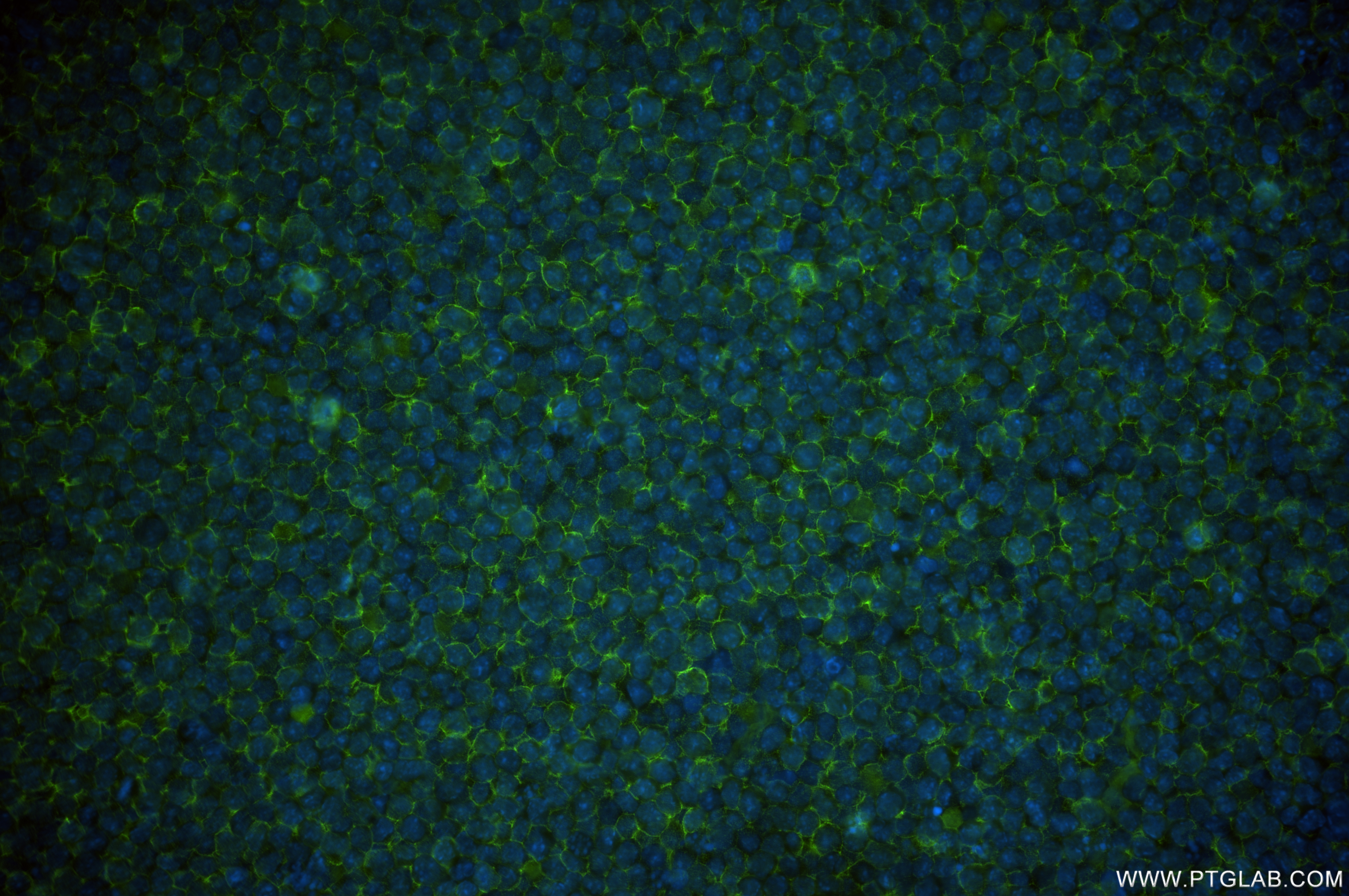IF Staining of A20 using 84754-5-RR