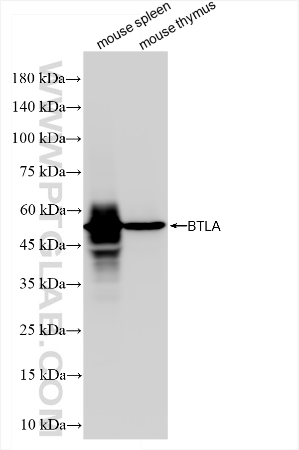 WB analysis using 84754-5-RR