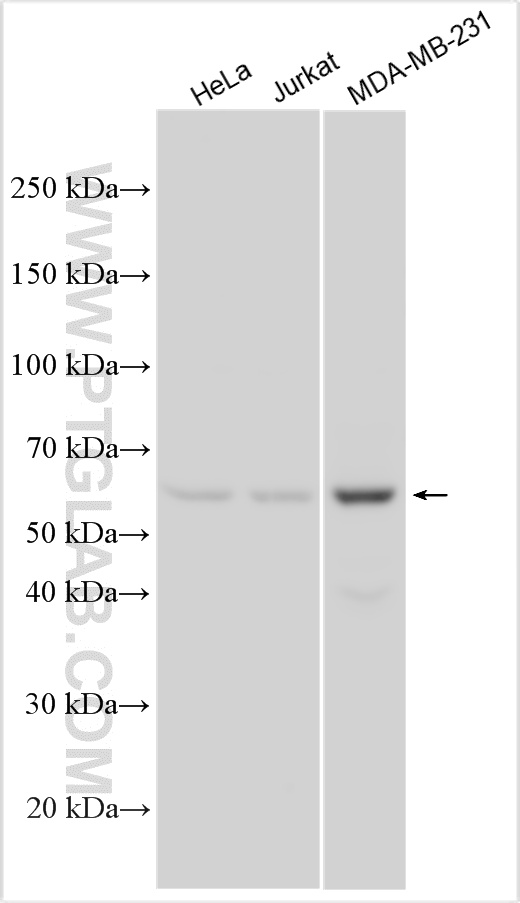 WB analysis using 32413-1-AP