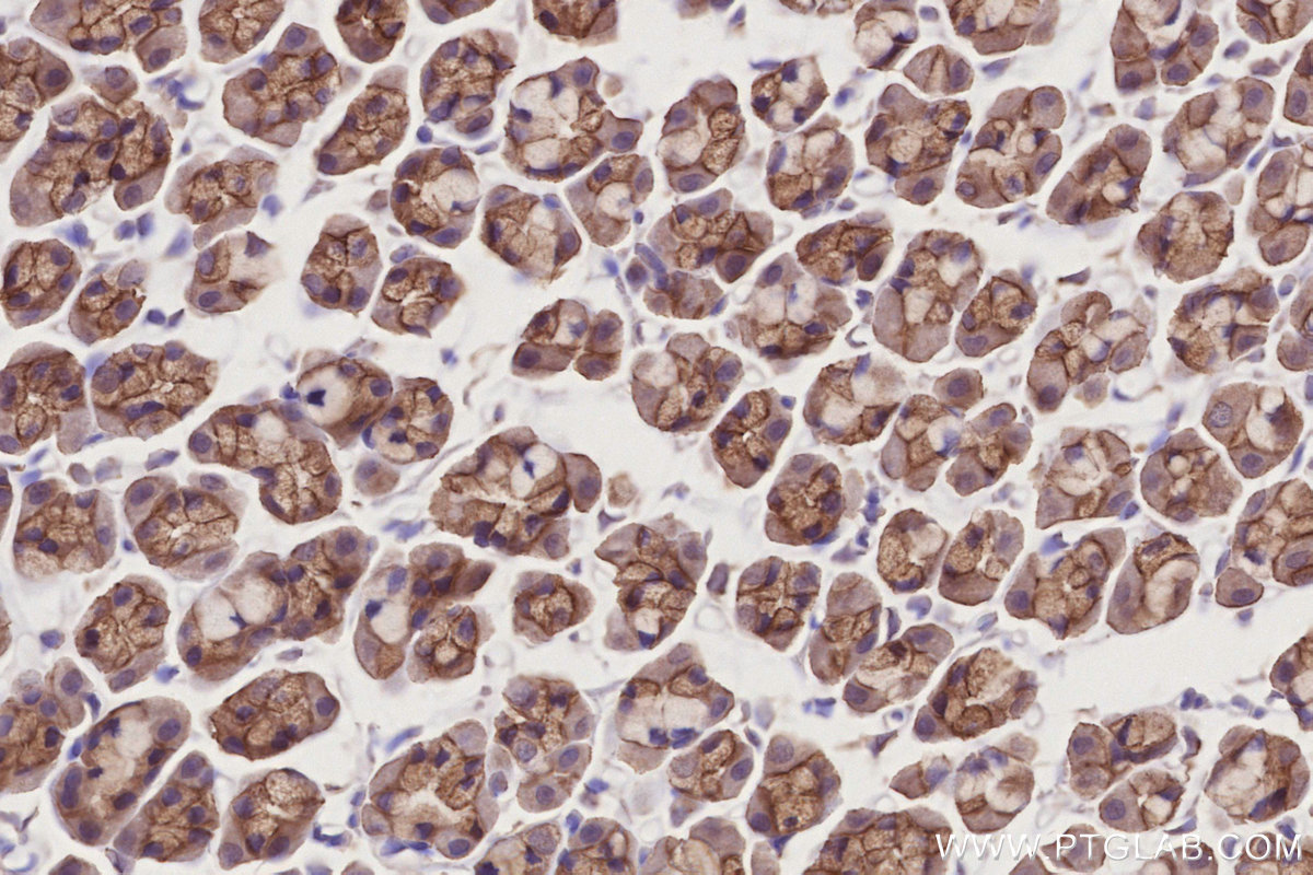 IHC staining of rat stomach using 16482-1-AP IHC staining of rat stomach using 16482-1-AP