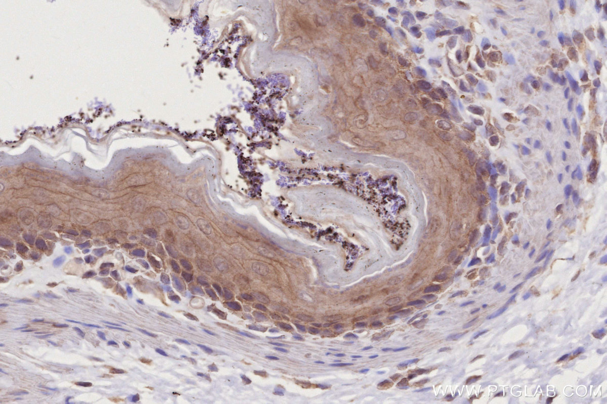 IHC staining of rat stomach using 16482-1-AP IHC staining of rat stomach using 16482-1-AP