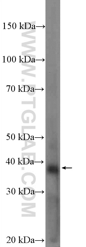 BTN3A2