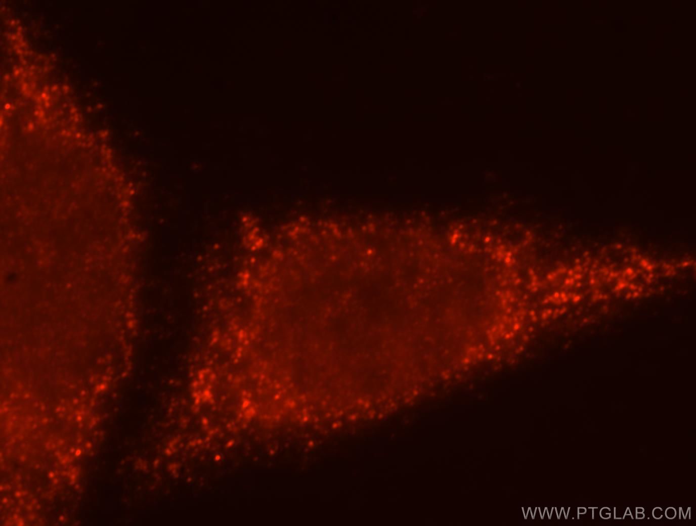 IF Staining of HepG2 using 15896-1-AP